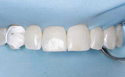 Odontología  restauradora